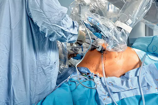 Ρομποτική χειρουργική από ουρολόγο